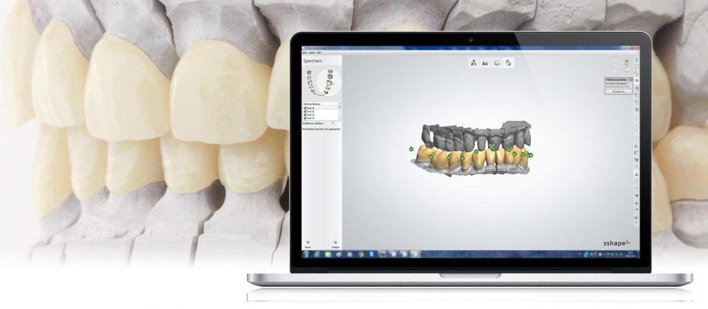 3D-Druck bei Zahnersatz: Mit der CAD-CAM-Technologie unterstützt Rißmann den digitalen Workflow bei der Fertigung von Zahnersatz.