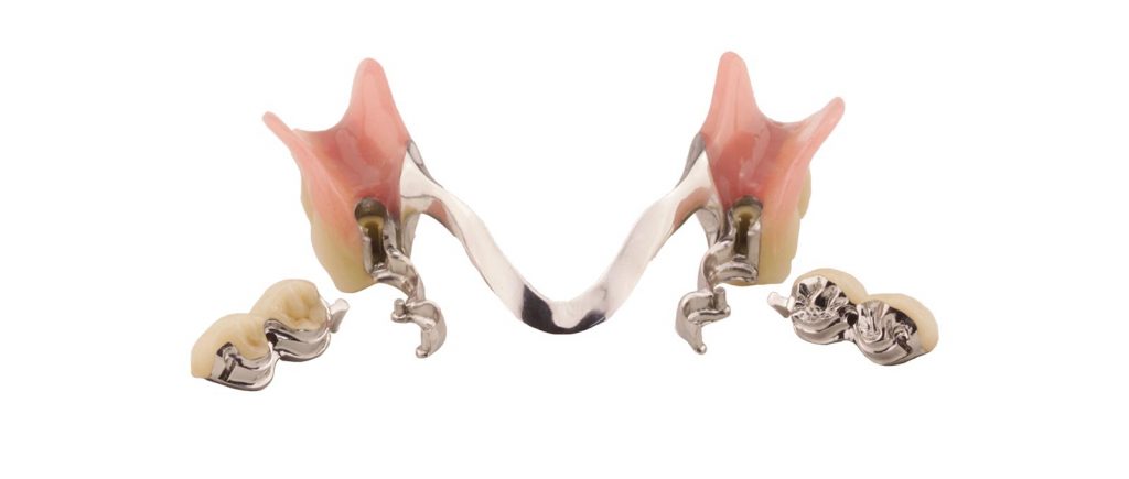 Ob Kombinationsprothese oder Teilprothese: Kombinationsprothetik von Rißmann Zahntechnik ist ein anspruchsvoller Zahnersatz.