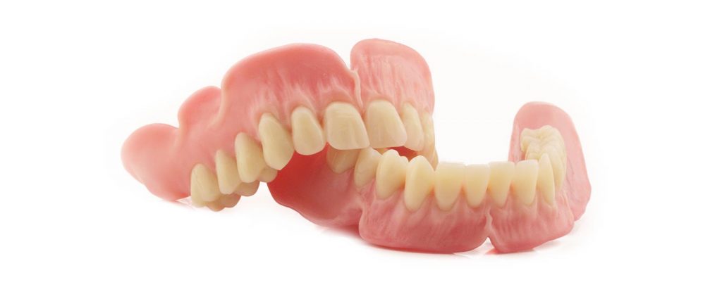 Anspruchsvolle Totalprothetik und Vollprothetik: Eine Totalprothese wie diese von Rißmann Zahntechnik ersetzt alle Zähne im zahnlosen Kiefer.