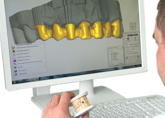 Digitaler Workflow bei schwandental Zahntechnik: Die Herstellung der physischen Modelle erfolgt in digitaler Handarbeit.